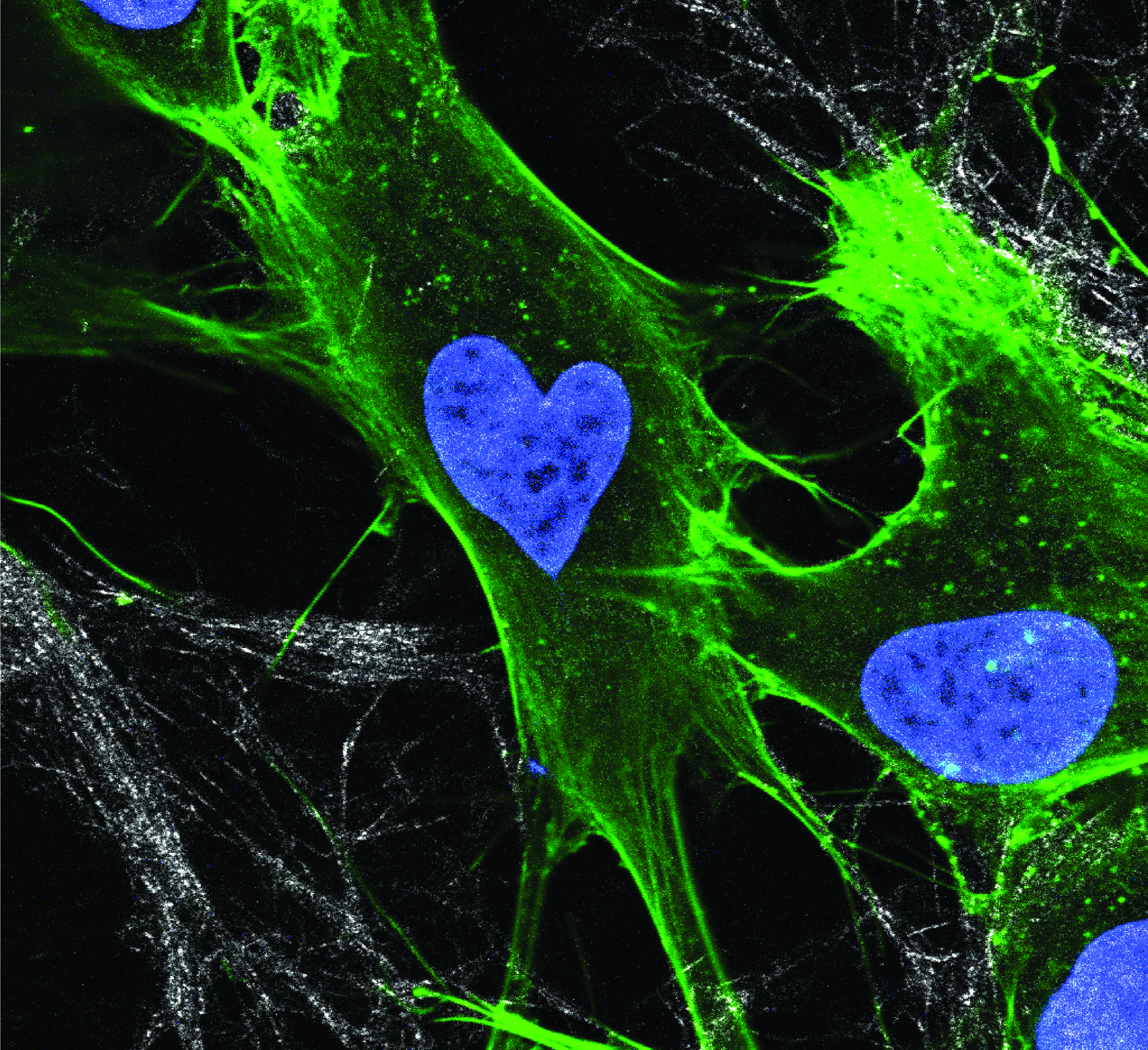 Fluorescence microscopy of fibroblast cells in 3D collagen matrix